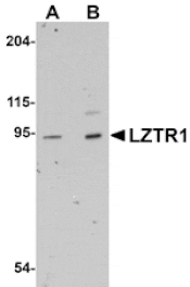 Western blot - LZTR1 Antibody from Signalway Antibody (25061) - Antibodies.com