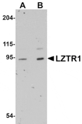 Western blot - LZTR1 Antibody from Signalway Antibody (25061) - Antibodies.com