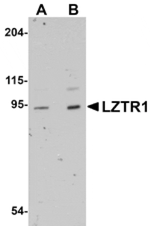 Western blot - LZTR1 Antibody from Signalway Antibody (25061) - Antibodies.com