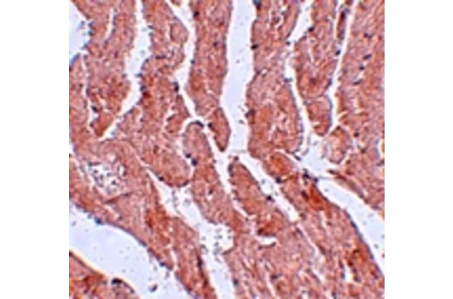 Immunohistochemistry - LZTR1 Antibody from Signalway Antibody (25061) - Antibodies.com