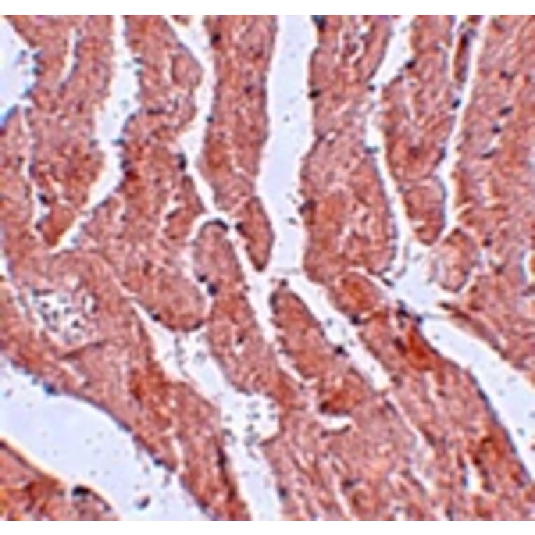Immunohistochemistry - LZTR1 Antibody from Signalway Antibody (25061) - Antibodies.com