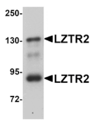 Western blot - LZTR2 Antibody from Signalway Antibody (25062) - Antibodies.com