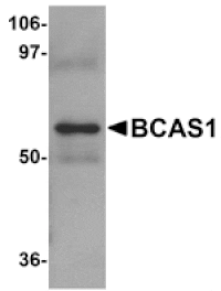 Western blot - BCAS1 Antibody from Signalway Antibody (25063) - Antibodies.com