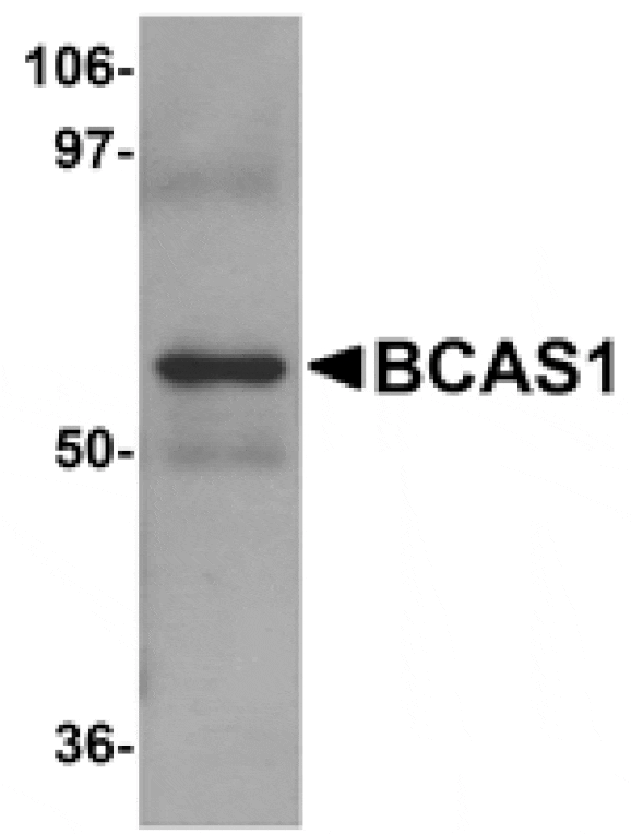 Western blot - BCAS1 Antibody from Signalway Antibody (25063) - Antibodies.com