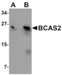 Western blot - BCAS2 Antibody from Signalway Antibody (25064) - Antibodies.com
