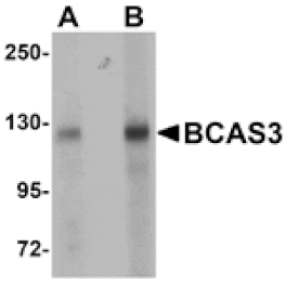 Western blot - BCAS3 Antibody from Signalway Antibody (25065) - Antibodies.com