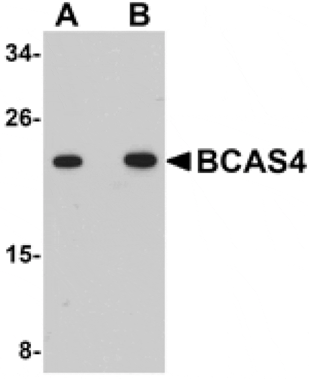 Western blot - BCAS4 Antibody from Signalway Antibody (25066) - Antibodies.com