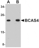 Western blot - BCAS4 Antibody from Signalway Antibody (25066) - Antibodies.com