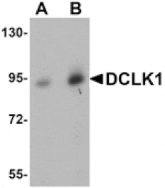 Western blot - DCLK1 Antibody from Signalway Antibody (25067) - Antibodies.com