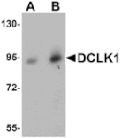 Western blot - DCLK1 Antibody from Signalway Antibody (25067) - Antibodies.com