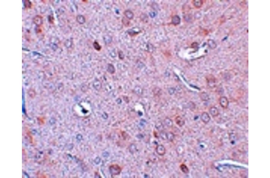 Immunohistochemistry - DCLK1 Antibody from Signalway Antibody (25067) - Antibodies.com