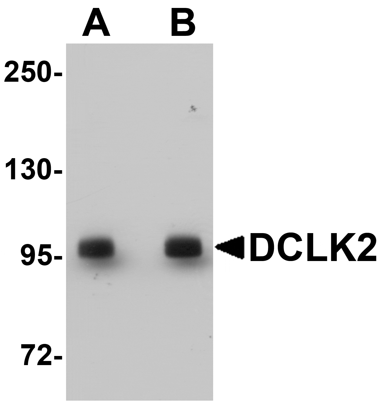 Western blot analysis of DCLK2 in rat brain tissue lysate with DCLK2 antibody at (A) 1 and (B) 2 µg/mL.