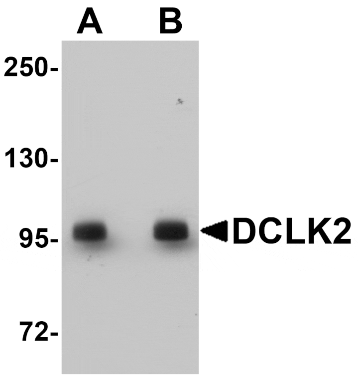 Western blot - DCLK2 Antibody from Signalway Antibody (25068) - Antibodies.com