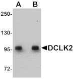 Western blot - DCLK2 Antibody from Signalway Antibody (25068) - Antibodies.com