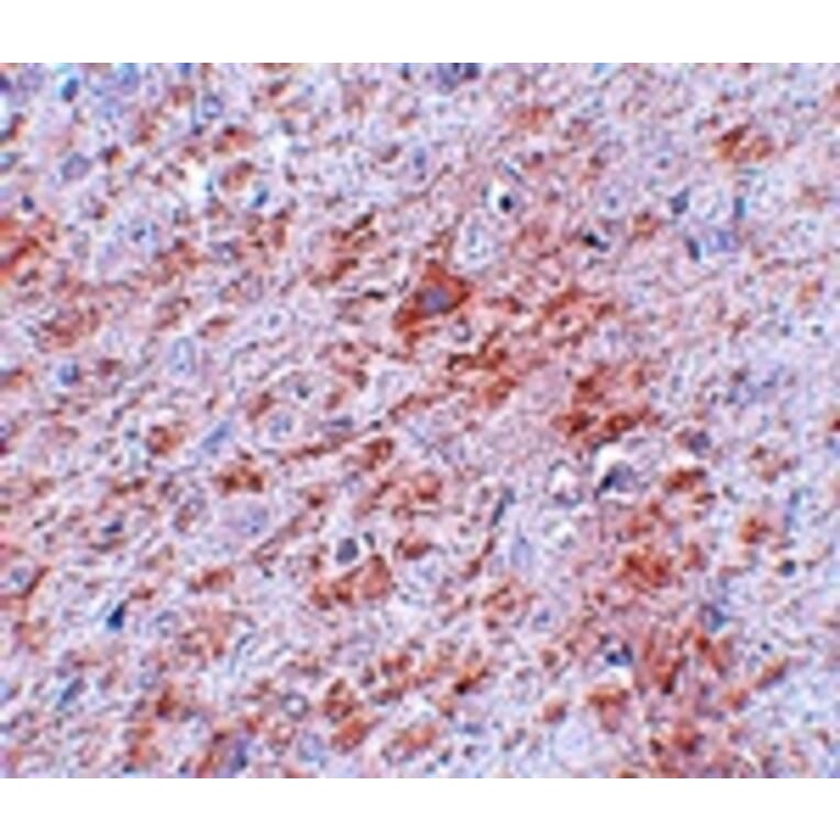Immunohistochemistry - DCLK2 Antibody from Signalway Antibody (25068) - Antibodies.com