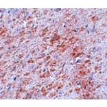 Immunohistochemistry - DCLK2 Antibody from Signalway Antibody (25068) - Antibodies.com