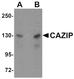 Western blot - CAZIP Antibody from Signalway Antibody (25070) - Antibodies.com