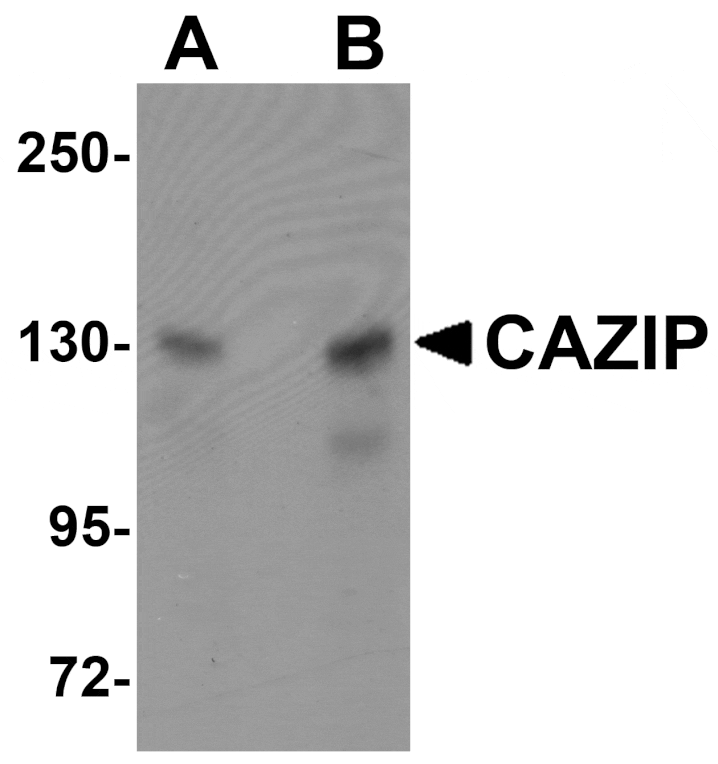 Western blot - CAZIP Antibody from Signalway Antibody (25070) - Antibodies.com