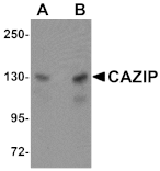 Western blot - CAZIP Antibody from Signalway Antibody (25070) - Antibodies.com
