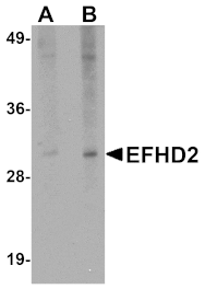 Western blot - EFHD2 Antibody from Signalway Antibody (25077) - Antibodies.com