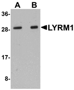 Western blot analysis of LYRM1 in human liver tissue lysate with LYRM1 antibody at (A) 1 and (B) 2 µg/mL.