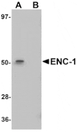Western blot - ENC-1 Antibody from Signalway Antibody (25094) - Antibodies.com