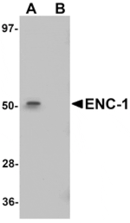 Western blot - ENC-1 Antibody from Signalway Antibody (25094) - Antibodies.com