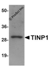 Western blot - TINP1 Antibody from Signalway Antibody (25098) - Antibodies.com