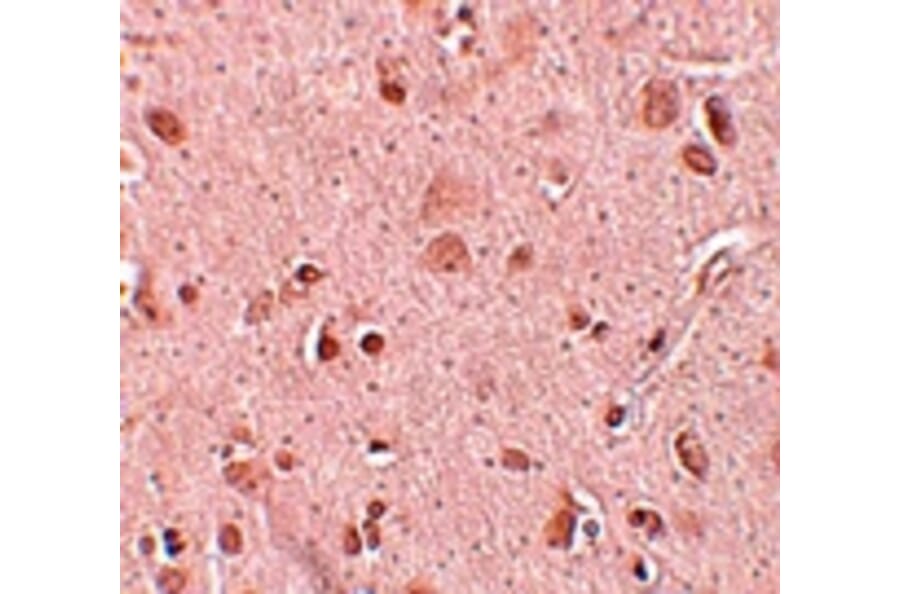 Immunohistochemistry - TINP1 Antibody from Signalway Antibody (25098) - Antibodies.com