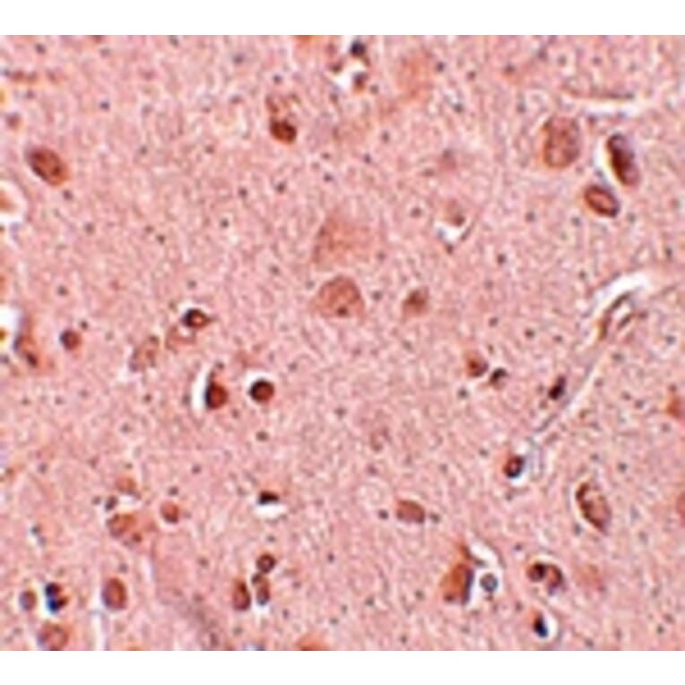 Immunohistochemistry - TINP1 Antibody from Signalway Antibody (25098) - Antibodies.com