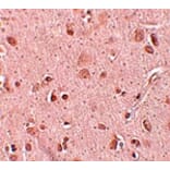 Immunohistochemistry - TINP1 Antibody from Signalway Antibody (25098) - Antibodies.com