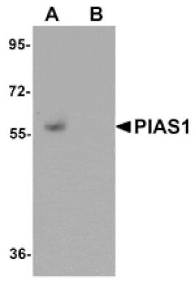 Western blot - PIAS1 Antibody from Signalway Antibody (25111) - Antibodies.com
