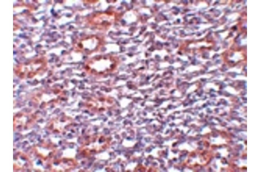 Immunohistochemistry - PIAS1 Antibody from Signalway Antibody (25111) - Antibodies.com