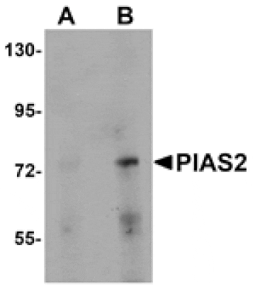 Western blot - PIAS2 Antibody from Signalway Antibody (25112) - Antibodies.com