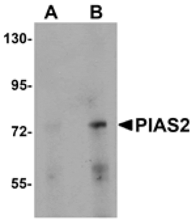 Western blot - PIAS2 Antibody from Signalway Antibody (25112) - Antibodies.com