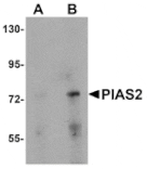 Western blot - PIAS2 Antibody from Signalway Antibody (25112) - Antibodies.com