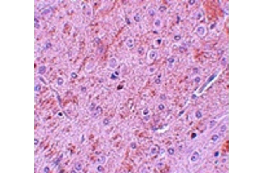 Immunohistochemistry - PIAS2 Antibody from Signalway Antibody (25112) - Antibodies.com