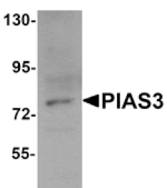 Western blot - PIAS3 Antibody from Signalway Antibody (25113) - Antibodies.com