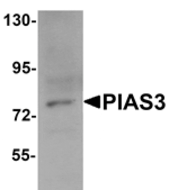 Western blot - PIAS3 Antibody from Signalway Antibody (25113) - Antibodies.com