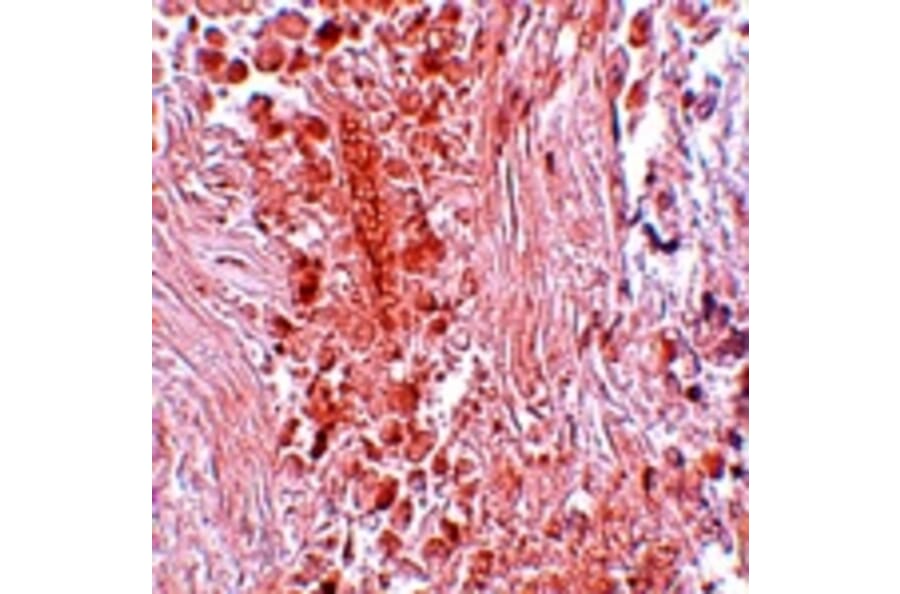 Immunohistochemistry - PIAS3 Antibody from Signalway Antibody (25113) - Antibodies.com