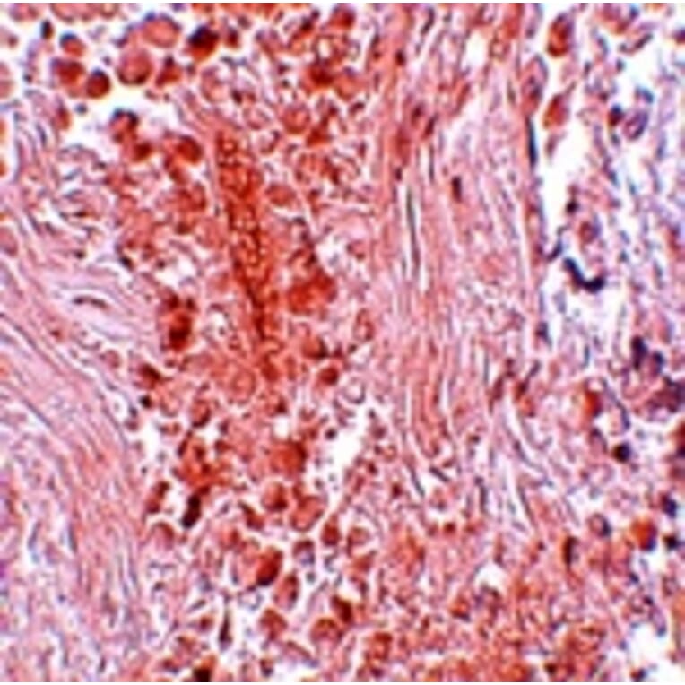 Immunohistochemistry - PIAS3 Antibody from Signalway Antibody (25113) - Antibodies.com