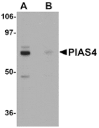 Western blot - PIAS4 Antibody from Signalway Antibody (25114) - Antibodies.com