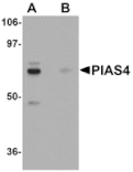 Western blot - PIAS4 Antibody from Signalway Antibody (25114) - Antibodies.com