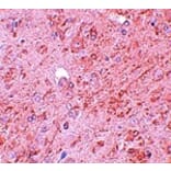 Immunohistochemistry - PIAS4 Antibody from Signalway Antibody (25114) - Antibodies.com