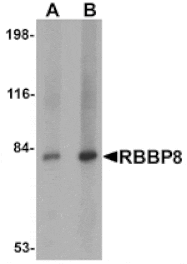 Western blot - RBBP8 Antibody from Signalway Antibody (25120) - Antibodies.com