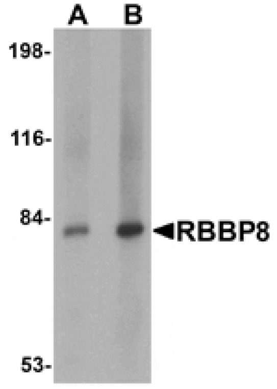 Western blot - RBBP8 Antibody from Signalway Antibody (25120) - Antibodies.com