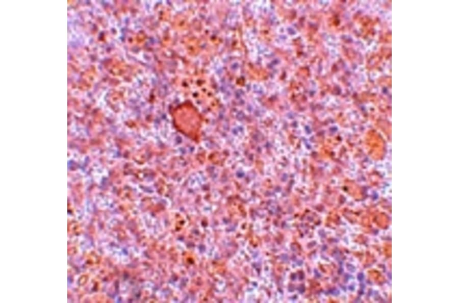 Immunohistochemistry - RBBP8 Antibody from Signalway Antibody (25120) - Antibodies.com