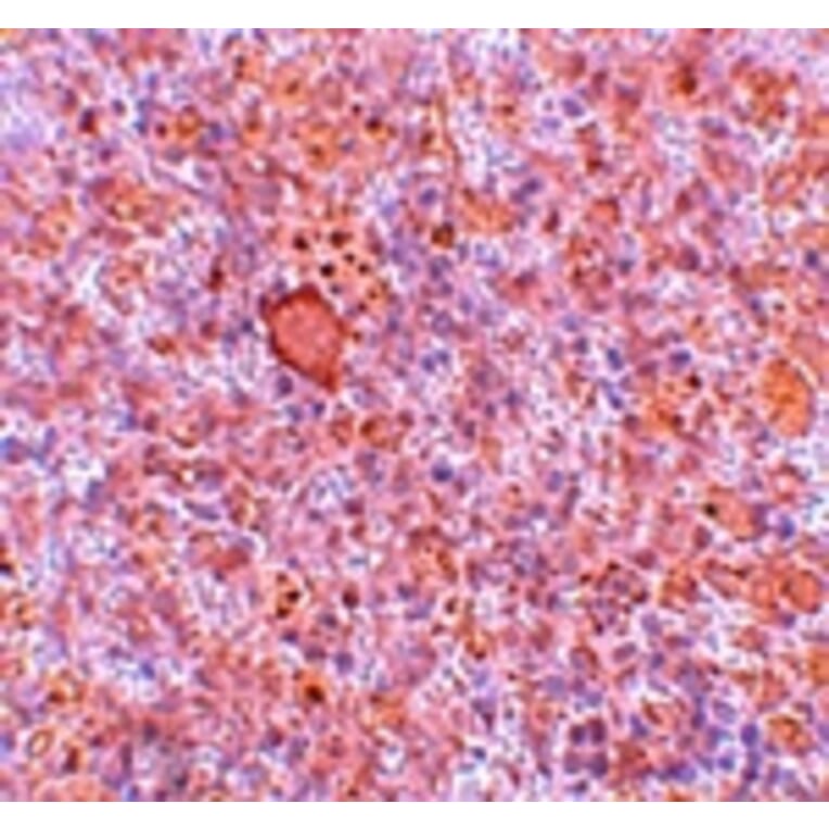 Immunohistochemistry - RBBP8 Antibody from Signalway Antibody (25120) - Antibodies.com