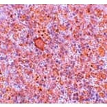 Immunohistochemistry - RBBP8 Antibody from Signalway Antibody (25120) - Antibodies.com