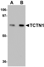 Western blot analysis of TCTN1 in mouse kidney tissue lysate with TCTN1 antibody at (A) 1 and (B) 2ug/mL.